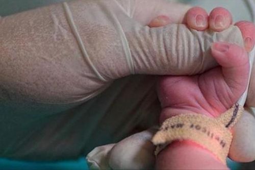 Mali ghi nhận ca sinh 9 hiếm có trên thế giới