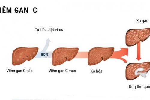Tương tác giữa rượu và virus viêm gan C