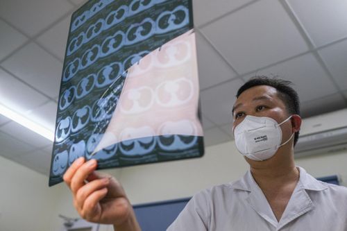 Sức khỏe một bệnh nhân Covid-19 được tiên lượng xấu