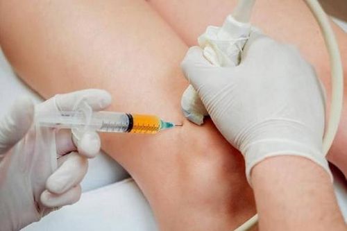 Bệnh viêm khớp: Khi nào cần tiêm corticoid?