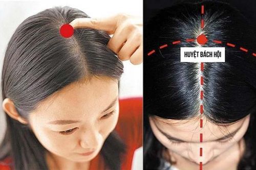 Bài thuốc trị thiếu máu não