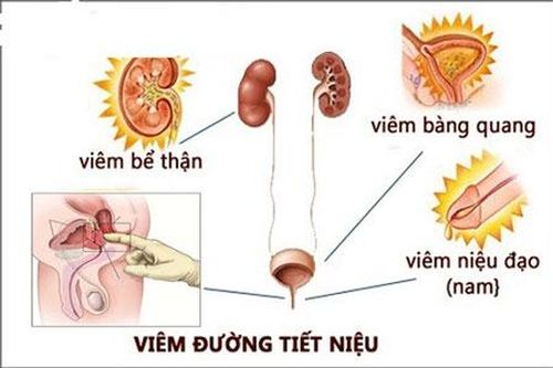 Bấm huyệt trị liệu tiểu tiện không kiểm soát