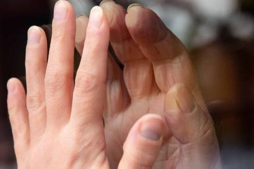 Ưu tiên chống Covid-19, châu Âu đơn giản hóa các thủ tục kiểm duyệt dược phẩm khác