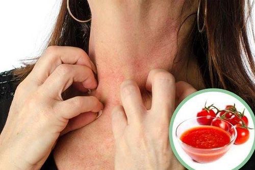5 nhóm người tuyệt đối không nên ăn cà chua