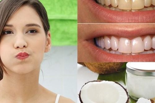 Mẹo làm trắng răng, không ê buốt tại nhà
