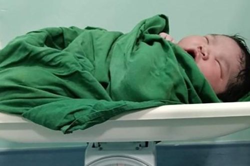 Quảng Nam: Một sản phụ sinh cháu bé nặng gần 6 kg