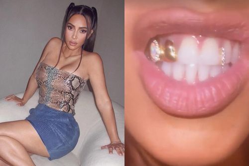 Kim Kardashian đính kim cương lên răng