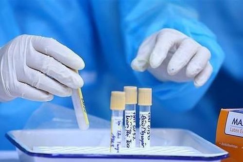 Lãnh đạo Bộ Y tế nói về hệ lụy khi người dân 'đổ xô' xét nghiệm SARS-CoV-2