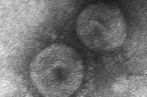 Virus Corona chỉ gây bệnh cho chó lại xuất hiện ở người viêm phổi