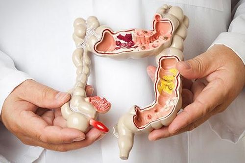 Ngăn chặn hiểm họa ung thư từ bệnh tiêu hóa