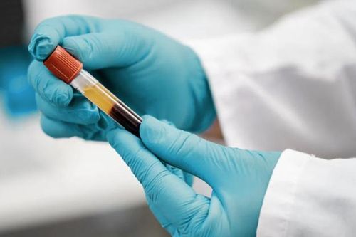 Thử nghiệm kỹ thuật xét nghiệm doping mới tại Olympic Tokyo