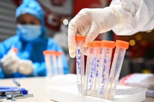 Đà Nẵng triển khai xét nghiệm SARS-CoV-2 cho người lao động