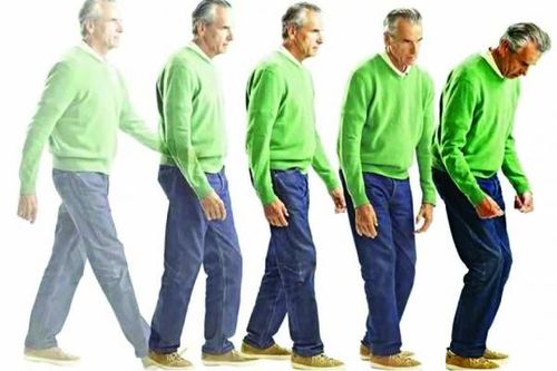 Bệnh Parkinson có thể là nguyên nhân của vấn đề tiêu hóa