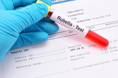 Phụ nữ có thai cần làm gì khi phát hiện Rubella IgG dương tính?