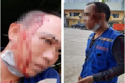 Tranh giành ép biển số ô tô, một thanh niên bị đâm giữa phố Hà Nội