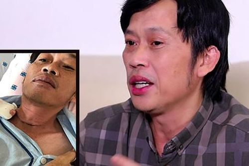 Căn bệnh ung thư nghệ sĩ Hoài Linh vừa đột ngột phát hiện giữa lùm xùm từ thiện nguy hiểm ra sao?
