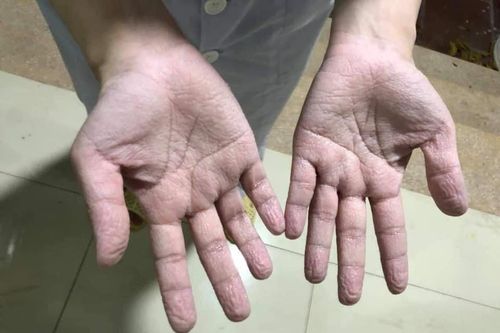 Đội quân áo trắng giữa tâm dịch Covid-19 ở Bắc Giang
