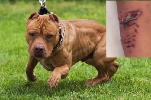 Ông bố bàng hoàng kể lại giây phút giằng co với con chó pitbull nặng 30kg cứu con trai 2 tuổi