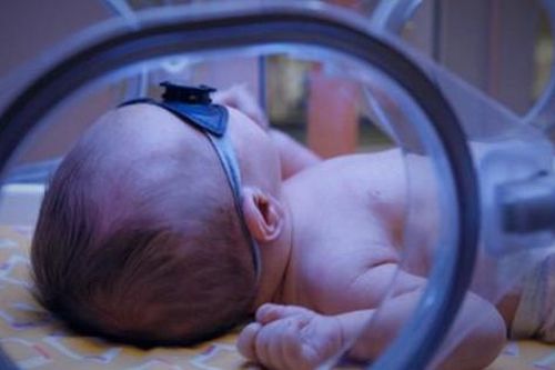Trẻ sơ sinh bị vàng da nguy kịch tính mạng vì cách mà nhiều cha mẹ vẫn đang truyền nhau làm