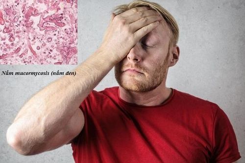 Đau đầu sau COVID-19: Cảnh báo nhiễm trùng nấm đen
