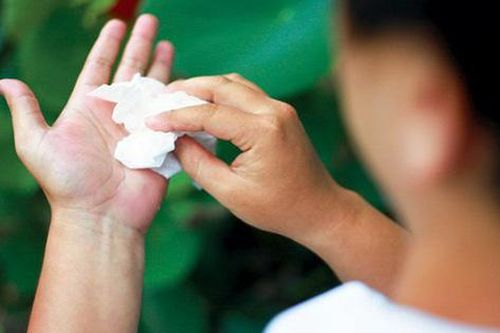 Khổ sở vì bàn tay tiết quá nhiều mồ hôi: Bác sỹ tư vấn hướng điều trị