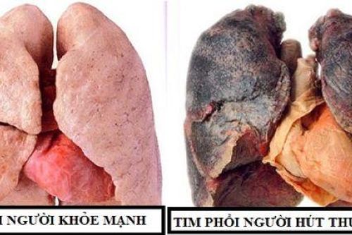 Nguy hiểm của khói thuốc lá trong đại dịch COVID-19
