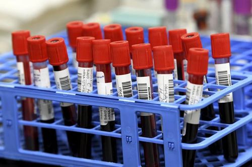 Công nghệ mRNA trong vaccine COVID-19 còn giúp chống nhiều bệnh khác