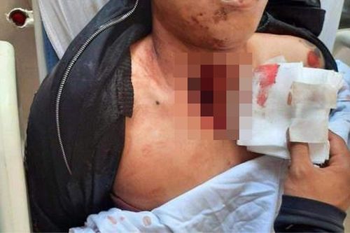 Nghi phạm chém chết thanh niên trên đường trong đêm đã bị bắt