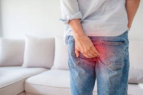 Đau rát, chảy máu tái phát nhiều do trĩ cấp và biện pháp cải thiện