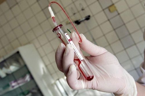 Phát hiện đột biến của nCoV trong cơ thể bệnh nhân HIV