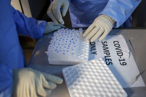 SARS-CoV-2 đột biến kỳ lạ trong cơ thể người phụ nữ mắc COVID-19 suốt 7 tháng