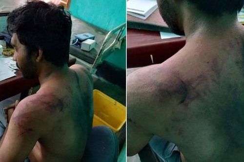 Ấn Độ: Bệnh nhân qua đời vì COVID-19, bác sĩ bị đánh đập dã man
