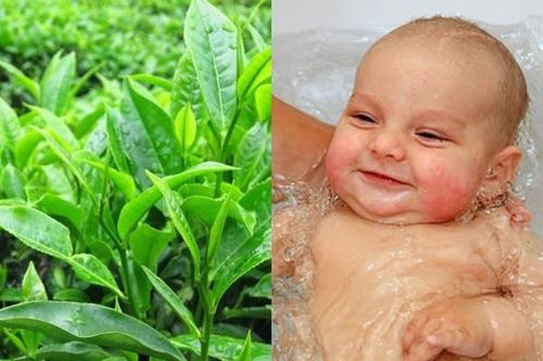 Mẹo trị rôm sảy cho bé ngày hè an toàn và hiệu quả