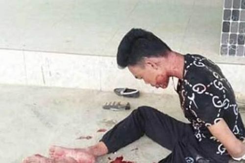 Nghĩ có người giết mình, gã chồng ngáo đá siết cổ vợ rồi tự sát