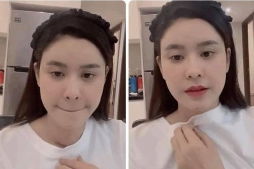Sau Hoài Linh, Trương Quỳnh Anh tiết lộ mắc bệnh tuyến giáp, vừa phẫu thuật với vết mổ dài