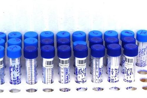 TPHCM: Lý do ca mắc COVID-19 tử vong trên đường chuyển viện nhưng xét nghiệm lại âm tính