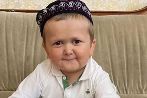 Hy hữu: Chàng trai 18 tuổi sở hữu gương mặt của trẻ lên 3