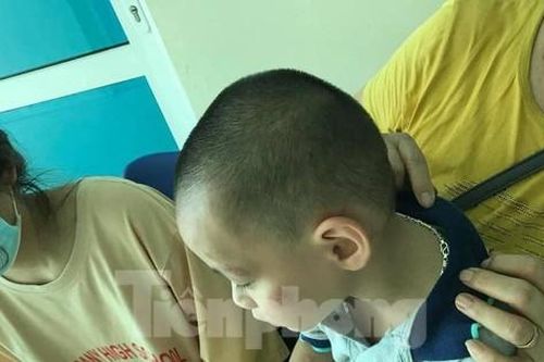 Kinh hoàng chó dại cắn liên tiếp 6 người ở Lạng Sơn