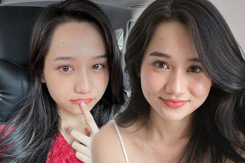 Trúc Anh 'Mắt Biếc' tự ti về 1 bộ phận trên gương mặt