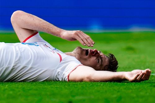 Video Croatia - CH Czech: Tiền đạo bị vỡ mũi