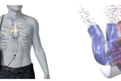 Sắp có tim nhân tạo toàn phần đầu tiên trên thế giới