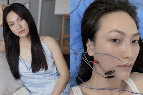 Nữ diễn viên Vbiz chia sẻ bị bệnh tuyến giáp, hoảng vì tê cứng và méo khung môi