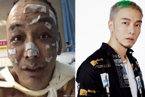 Nam rapper Trung Quốc bị bỏng nặng sau vụ cháy nhà