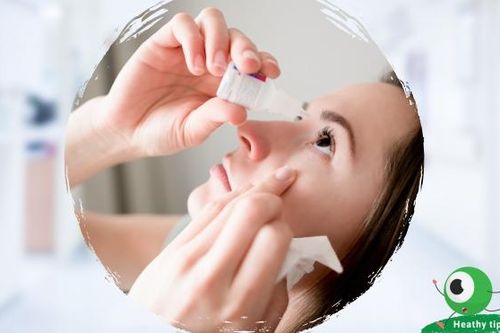 Hướng dẫn chăm sóc sau phẫu thuật Lasik tại nhà