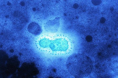 Phát hiện mới về đại dịch do virus corona tấn công 20.000 năm trước