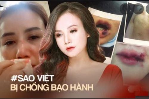 Sao Việt bị chồng bạo hành: Kiều Trinh chấn thương hộp sọ, Hoa hậu Diễm Hương định tự tử