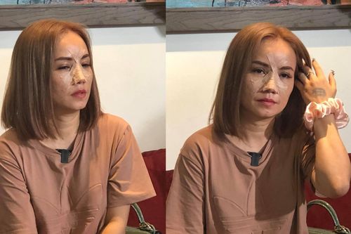 Vừa bị chồng cũ hành hung, diễn viên Hoàng Yến nói điều không ai ngờ