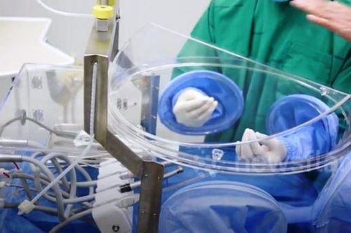 Thái Lan ra mắt bong bóng phòng COVID-19 cho nha sĩ đầu tiên trên thế giới