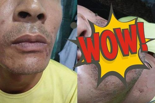 Ông bố 'chất chơi' trốn vợ con đi phun xăm môi và cái kết bất ngờ