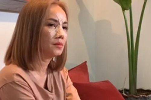 Động thái cứng rắn của 'cô Xuyến' Hoàng Yến với chồng cũ: Nhờ luật sư vào cuộc vụ đấm vỡ mũi ở quán ăn